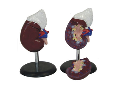 XC301-3 Kidney Model with Adrenaline Glands